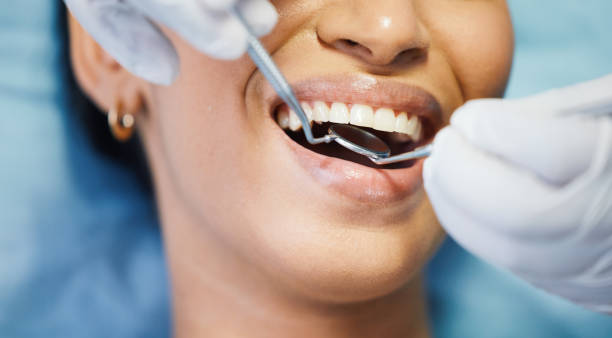 Best Emergency Denture Repair in Worthington, OH